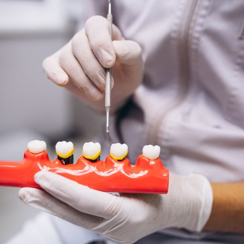 estetica dental
