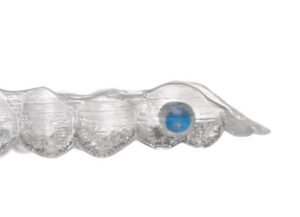invisalign-en-teruel