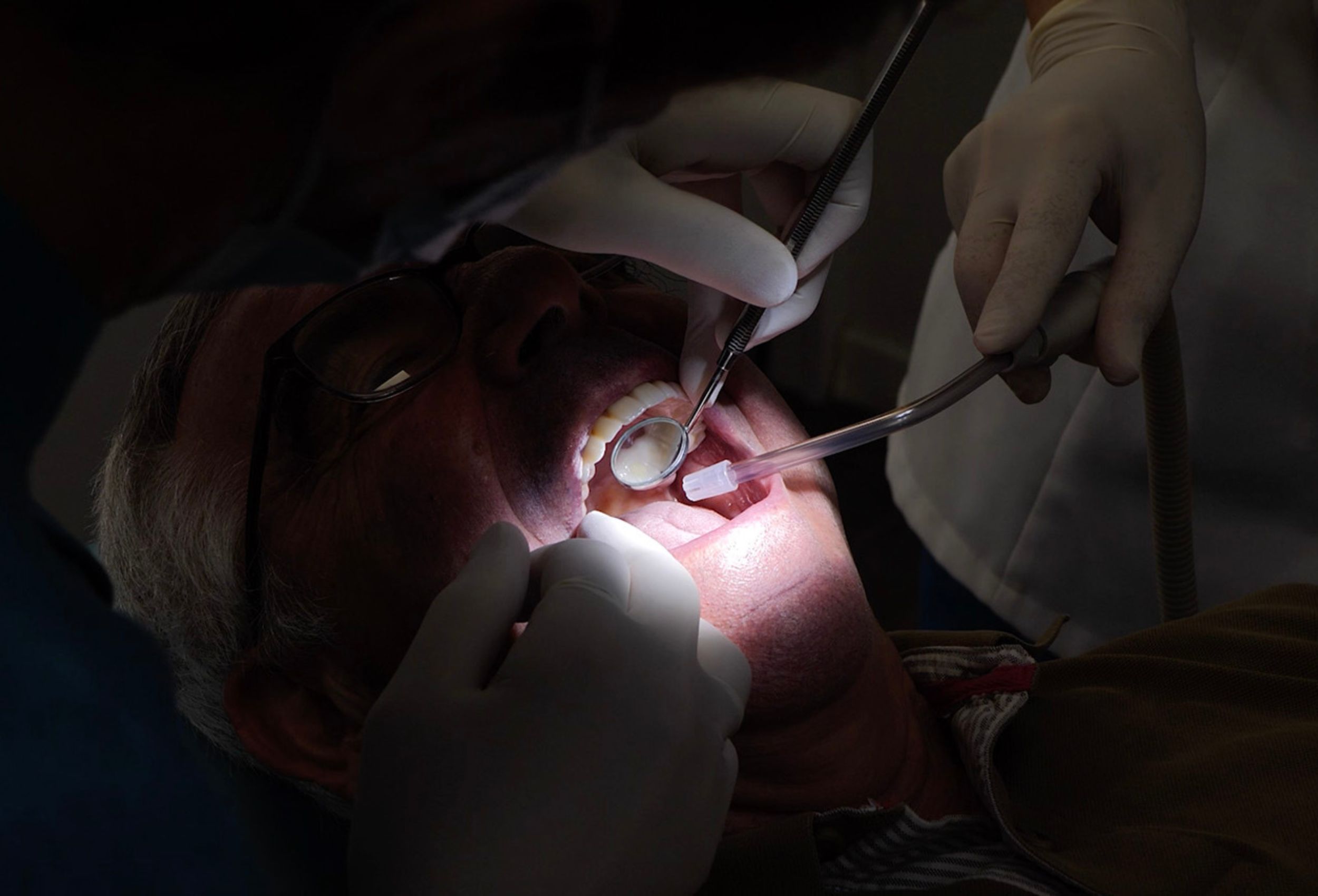 blanqueamiento teruel