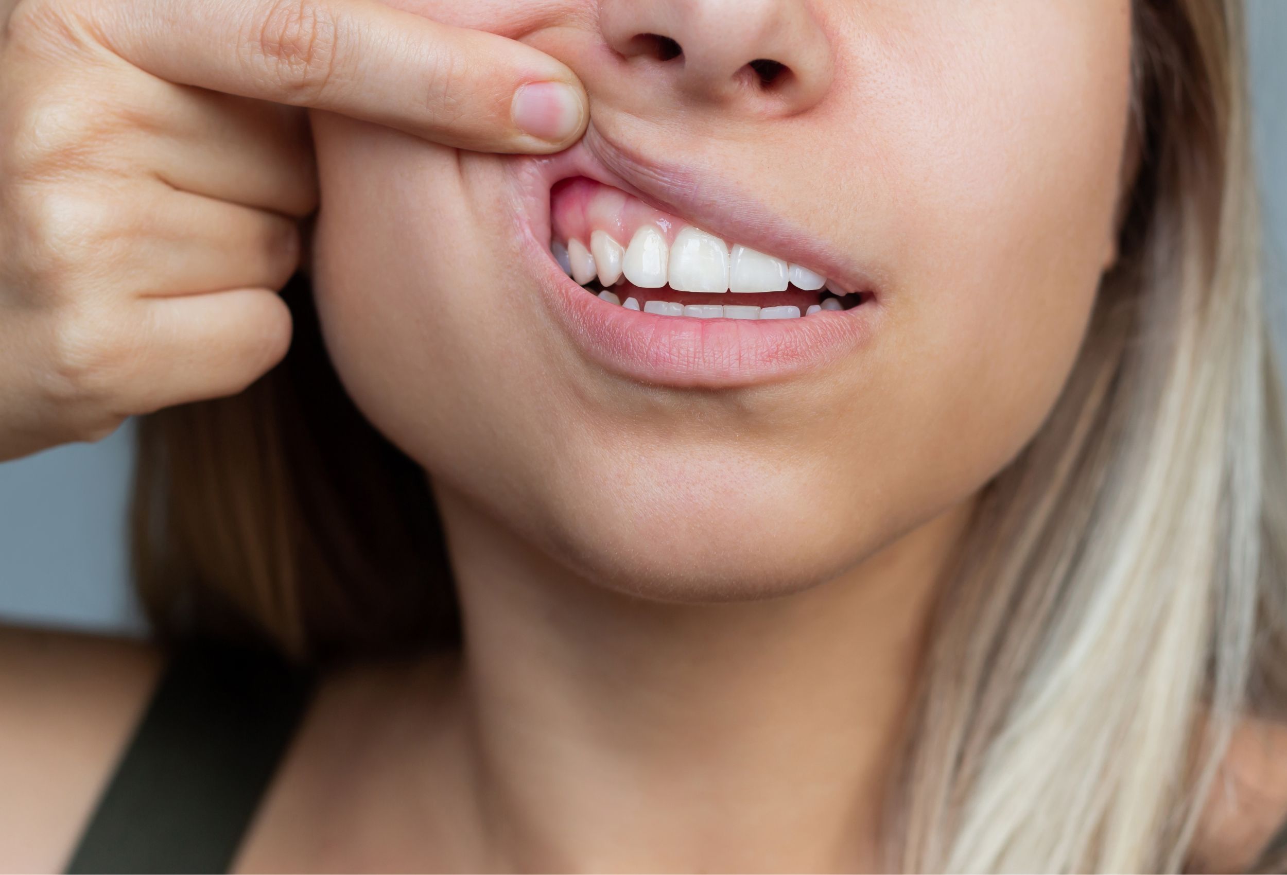 flemon dental