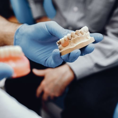 clinica estetica dental teruel