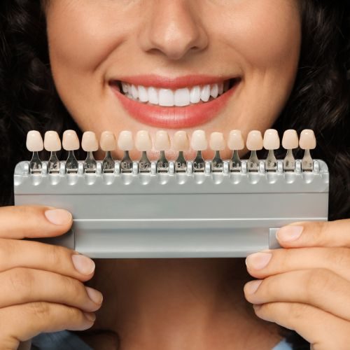 estetica dental en teruel