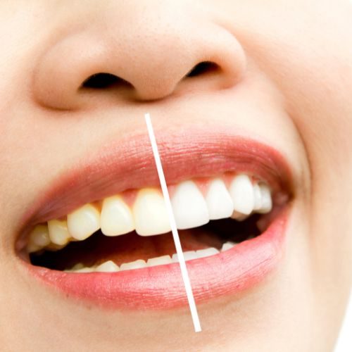 estetica dental