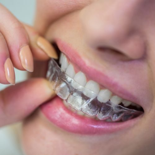 estetica-dental-teruel